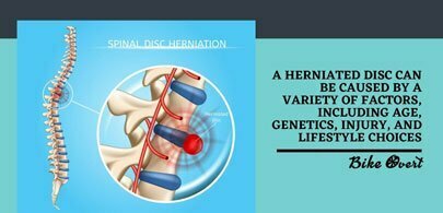 What are the actual causes of herniated disc?